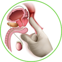 activ greens para la prostata
